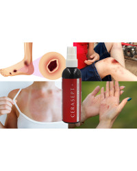 Płyn Po Radioterapii i Mastektomii Cerasept + Antybakteryjny 100ml