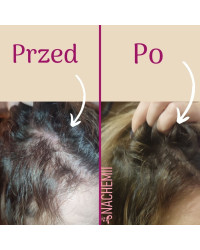 Serum stymulujące na porost włosów po chemioterapii Nachemii 100 ml