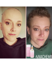 Serum stymulujące na porost włosów po chemioterapii Nachemii 100 ml