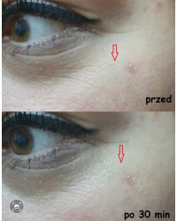 Serum do twarzy wygładzające przeciwzmarszczkowe Nachemii 30 ml