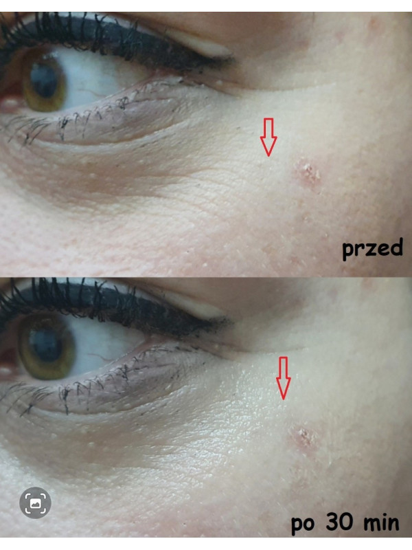 Serum do twarzy wygładzające przeciwzmarszczkowe Nachemii 30 ml