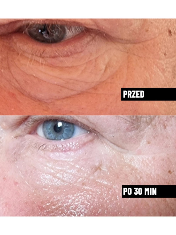 Serum do twarzy wygładzające przeciwzmarszczkowe Nachemii 30 ml