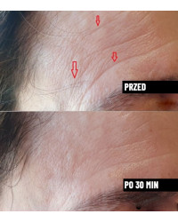 Serum do twarzy wygładzające przeciwzmarszczkowe Nachemii 30 ml