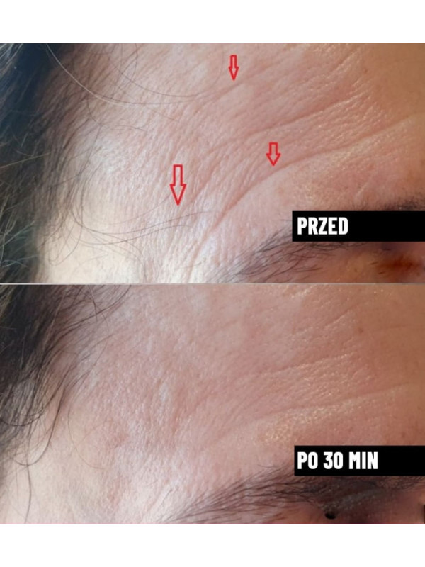 Serum do twarzy wygładzające przeciwzmarszczkowe Nachemii 30 ml