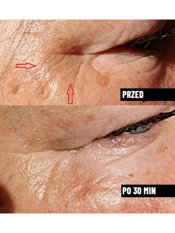 Serum do twarzy wygładzające przeciwzmarszczkowe Nachemii 30 ml