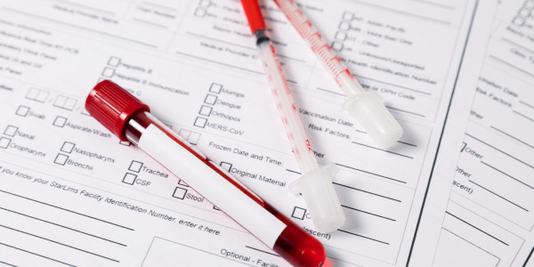 Jak często powinno się wykonywać badania przesiewowe?